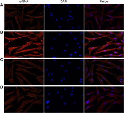 Vincristine Promotes Transdifferentiation of Fibroblasts Into Myofibroblasts via P38 and ERK Signal Pathways